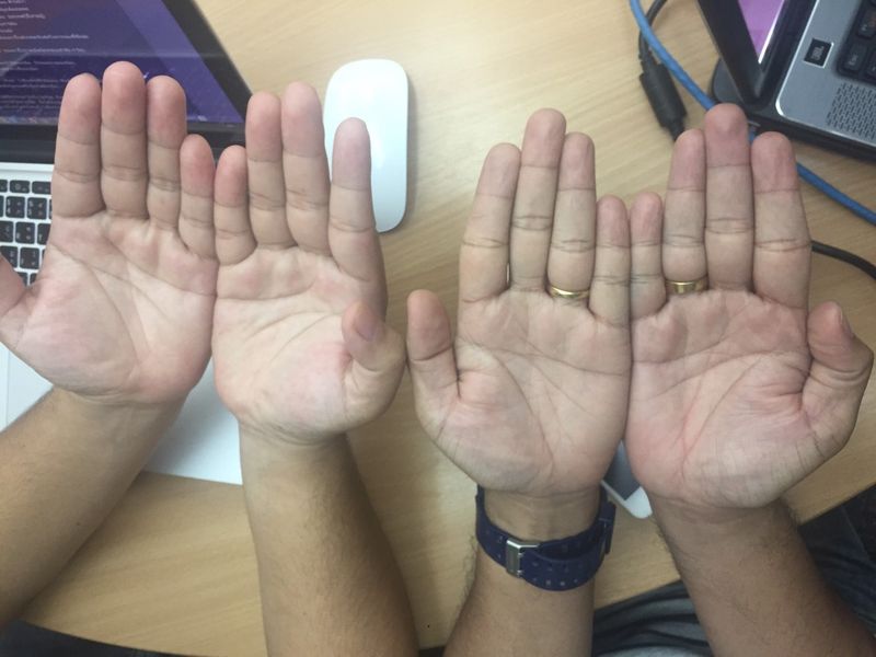 ทายใจทายนิสัย จากสีของมือ